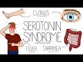 Serotonin Syndrome Explained Serotonin Toxicity
