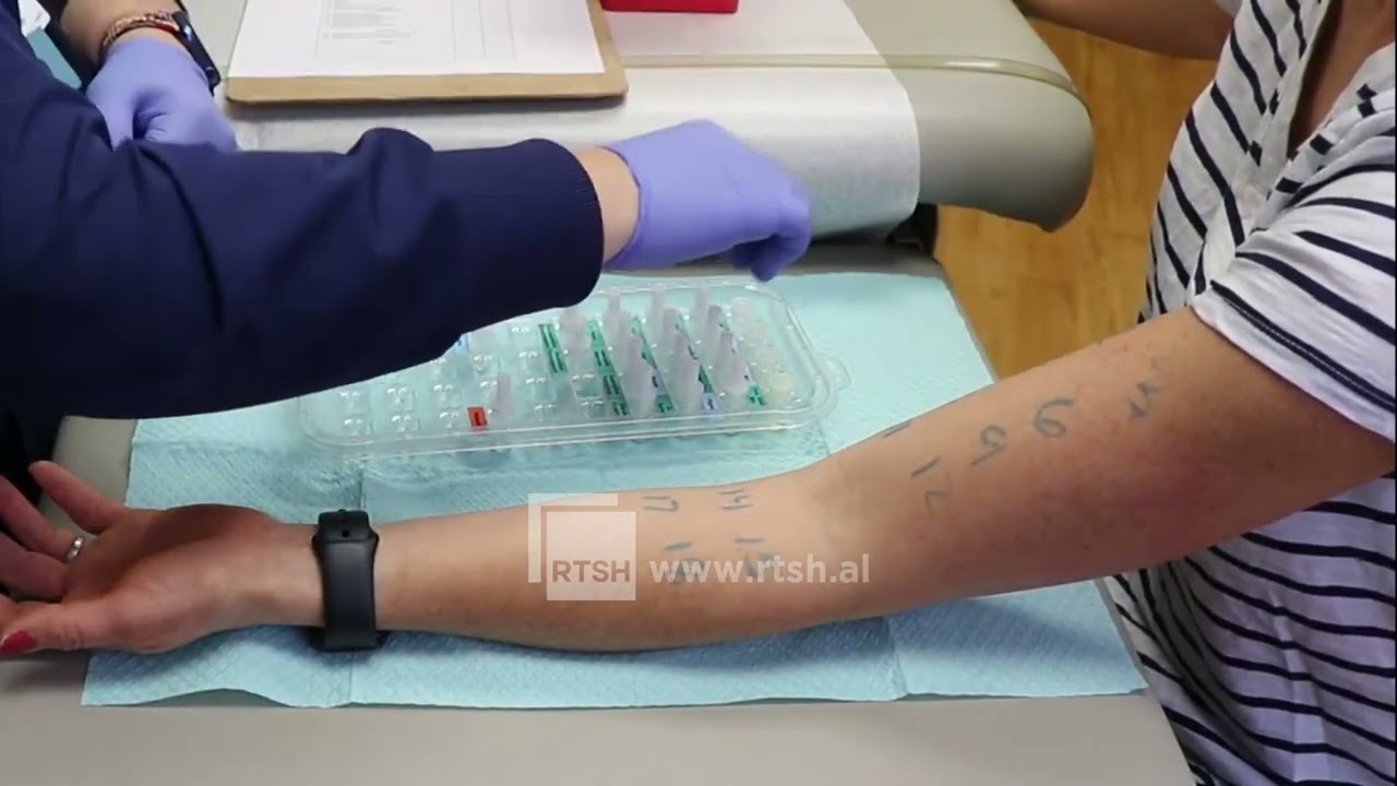 Alergjitë- Imunoterapia mes skepticizmit dhe shkencës, mjeku: Nuk është vaksinë, ka zero efekte anësore