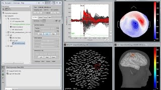Brainstorm: Imaging neural activity at the speed of brain