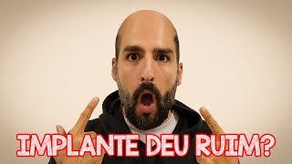 RESULTADO DO MEU IMPLANTE CAPILAR UM ANO DEPOIS - Quanto custou e onde eu fiz - Carro Chefe