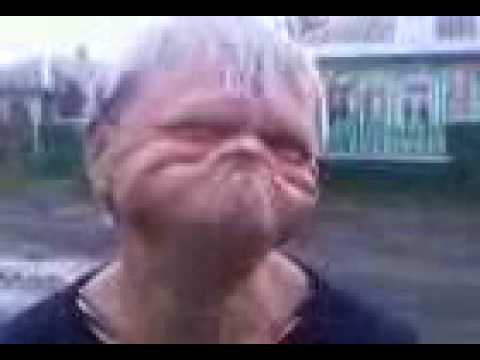 Człowiek guma 