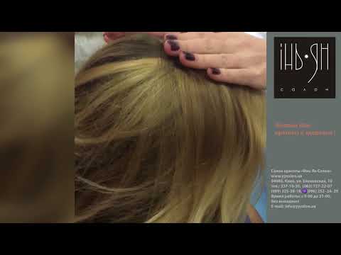 Учимся определять проблемы кожи головы