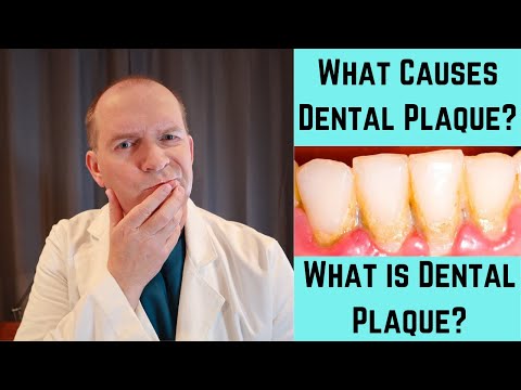 What Causes Dental Plaque? What is Dental Plaque?