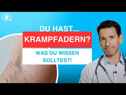 Krampfadern und Besenreiser: Wie lassen sie sich entfernen und wie kann man vorbeugen?