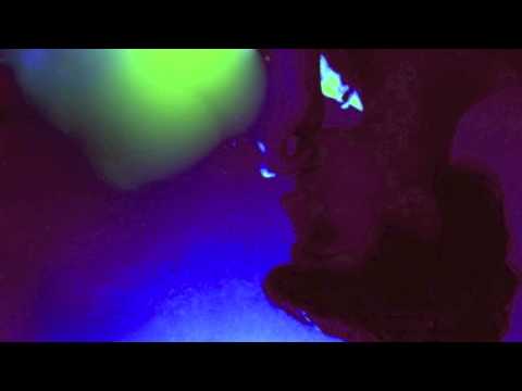 Local Anesthesia- Blerta Kosova