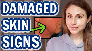 How to tell when your SKIN BARRIER IS DAMAGED| Dr Dray