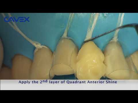 Quadrant Anterior Shine