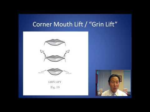 How Can I Fix My Permanent Frown - Corner Mouth Lift Consultation - Dr. Anthony Youn