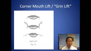 How Can I Fix My Permanent Frown - Corner Mouth Lift Consultation - Dr. Anthony Youn