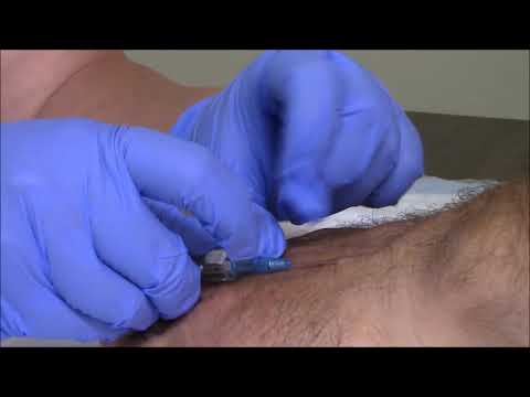 IV Insertion and Removal