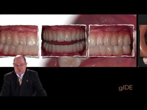 Newest Techniques on Implant Esthetics - Renzo Casellini - Librería Servicio Médico