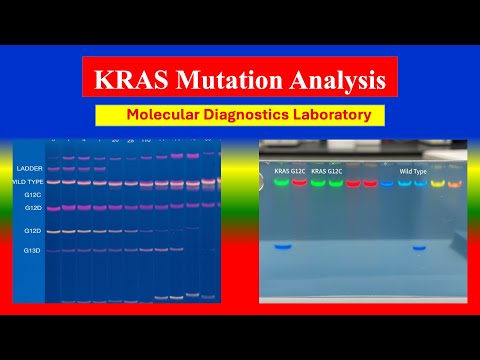 KRAS Mutation Analysis -  Definition , Uses , Need , Preparation , Results  , Normal Values