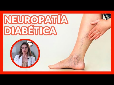 Neuropatía diabética | Clínica del Dolor I Dra. Yuriria Aguilar Carsolio