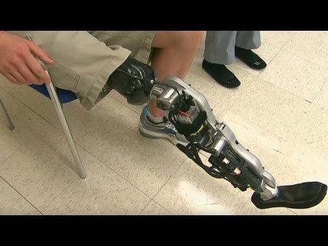 Bionic leg can 'read' brain signals to walk