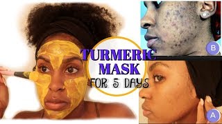 I Used a TURMERIC MASK for 1 Week and THIS HAPPENED! | How to Fade Dark Spots