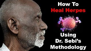 How To Heal Herpes - Using Dr. Sebi&#39;s Methodology