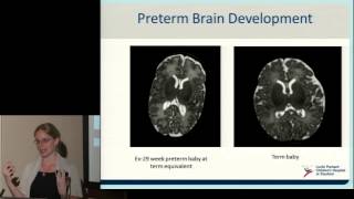 Neurodevelopment of Preterm Babies