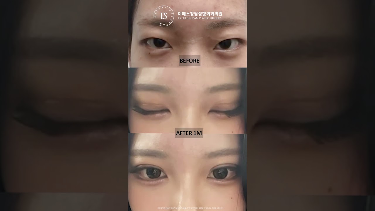 이에스 유튜브