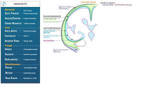 Meningitis - infectious disease etiologies by Ditki, Medical & Biological Sciences
