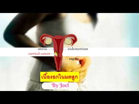 ร้านขายยาค้อน RU ของ ธ อร์ รายการความอ่อนแอ Bad
