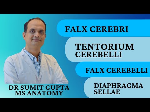 CRANIAL CAVITY : DURAMATER || FALX CEREBRI || TENTORIUM CEREBELLI ||