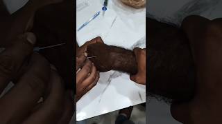 iv cannula insertion video, cannula kaise lgaye? #shorts #viral #hospital #doctor