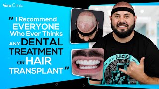 I Recommend Everyone Who Ever Thinks any Dental Treatment or Hair Tran