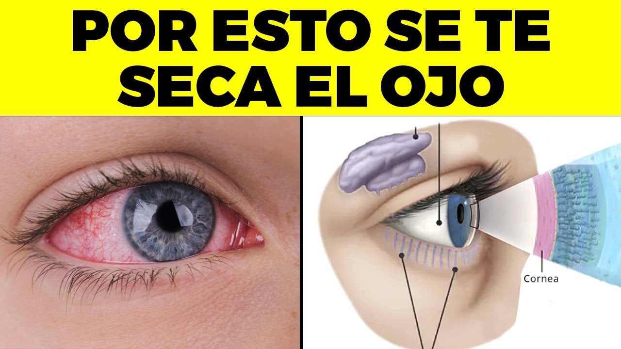 ALERTA! Por Esta Peligrosa Razón TIENES OJO SECO Y Nadie Te Lo Dice