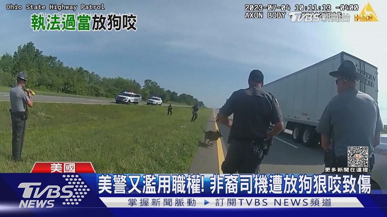 美國警察又濫用職權! 非裔司機遭放狗狠咬致傷