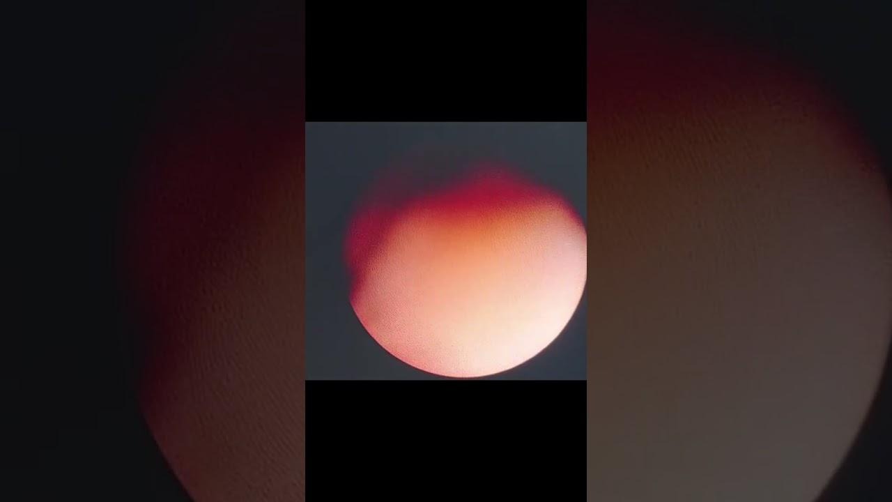 José Néstor Procuna Hernández-52