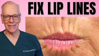 How a Plastic Surgeon Treats Lip Lines