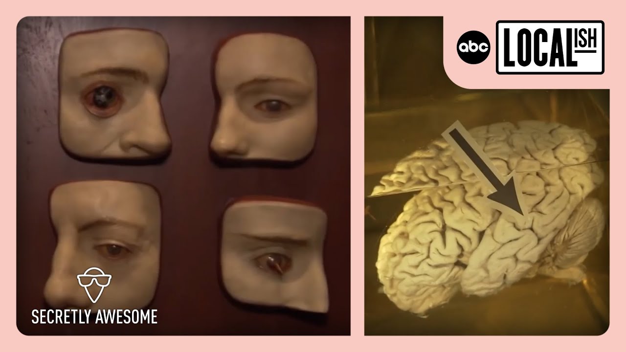 Mutter Museum Has Einstein's Brain Plus Other Creepy Exhibits | Secretly Awesome