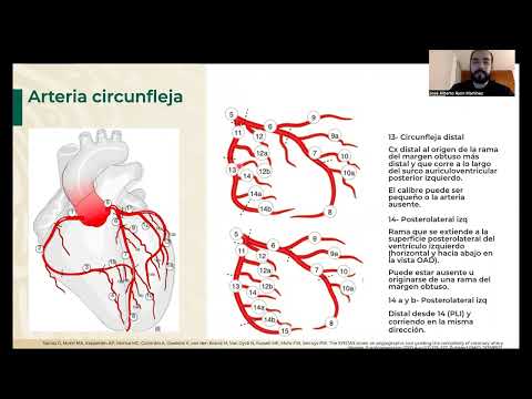 4. Anatomía coronaria
