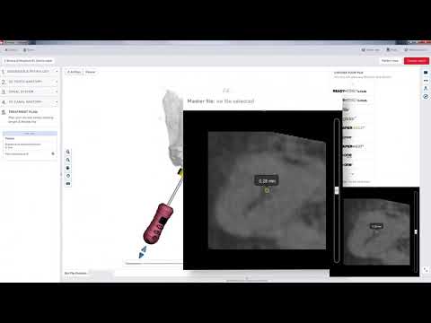 3D Endo - Master Apical File - #10 | Dentsply Sirona