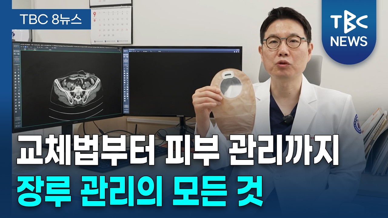 교체법부터 피부 관리까지, '장루환자를 위한 올바른 생활 지침' ㅣ 대장항문외과 정운경 교수