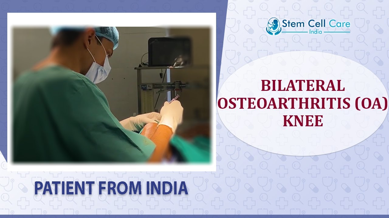 Patient With Bilateral Osteoarthritis (OA) Knee From India | Stem Cell Injection for Osteoarthritis