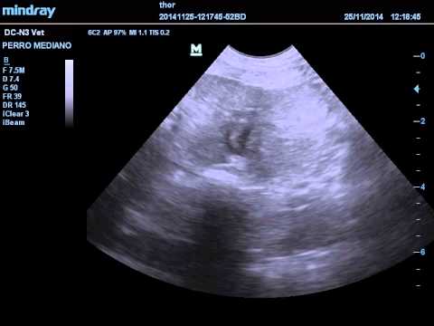 Posso mangiare anguria con prostatite Enucleazione laser della prostata adenoma prezzi Kiev