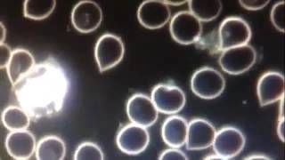 Oxidative Stress is damaged cells and this is what it looks like under microscope