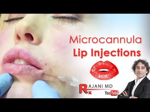 Larger Lips Tutorial Microcannula Filler Technique-Dr Rajani