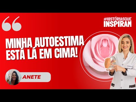 Anete recounts the BEFORE AND AFTER of perineoplasty surgery and microfocused ultrasound - EPISOD...