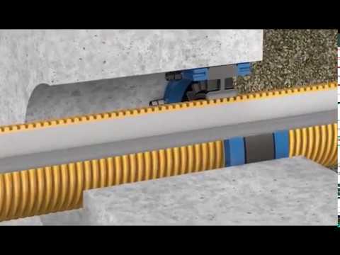 DOYMA Curaflex Nova® - STS - Soft Tight System