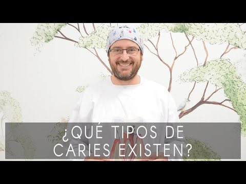 ¿Qué tipos de caries existen?