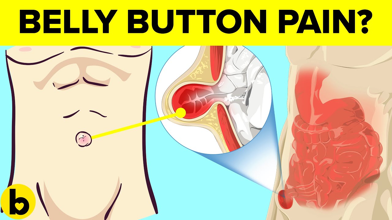 What does it mean when you have a sore inside your belly button? Tipseri