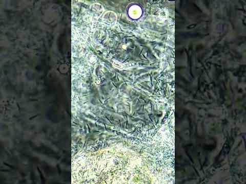 Bacteria VS hydrogen peroxide under the microscope