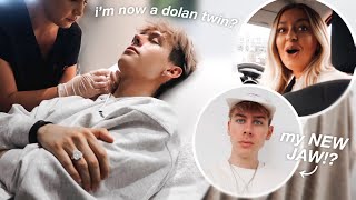 I got jaw filler to see how my friends would react!!