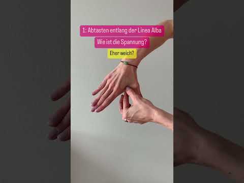 Teste deine Rektusdiastase - Kurzfassung