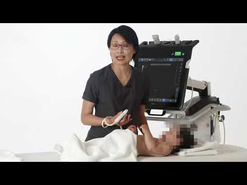 How to scan the anterior and lateral regions of the lung in neonates and children