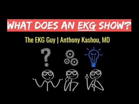 What does an EKG (ECG) show? | The EKG Guy