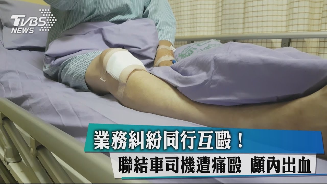 業務糾紛 聯結車司機遭痛打顱內出血
