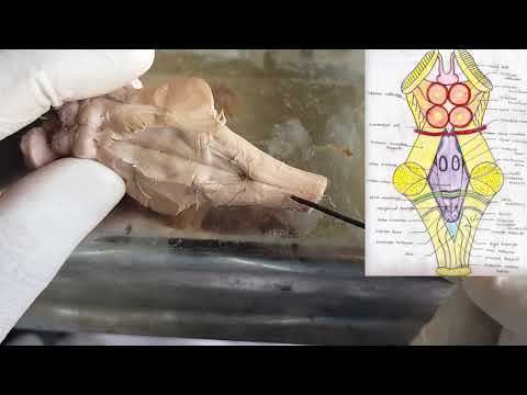 Brainstem - external features ( Gross Anatomy) Parts | Relations | Applied Anatomy